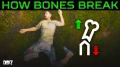 The Truth About Bone Regeneration in DayZ: How to Maximize L...
